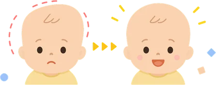 頭の形が改善した赤ちゃんのイラスト